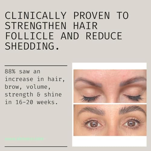 Marine Collagen Liquid 9000mg High Strength Supplement +Biotin, Vitamin B, C, E, Zinc & Turmeric & Ginger SKNZERO