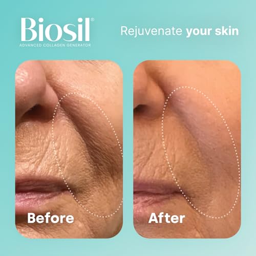 Biosil Collagen Generator - 120 Capsules - with Patented ch-OSA Complex - Generates & Protects Your Own Collagen BioSil