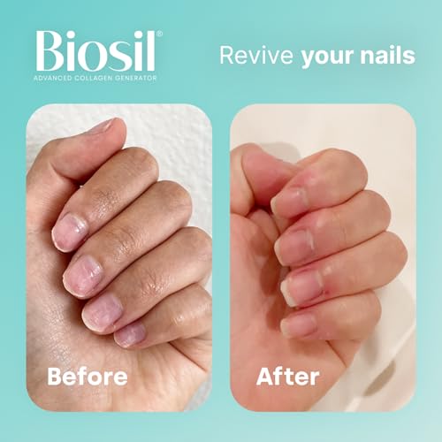 Biosil Collagen Generator - 60 Capsules - with Patented ch-OSA Complex - Generates & Protects Your Own Collagen BioSil