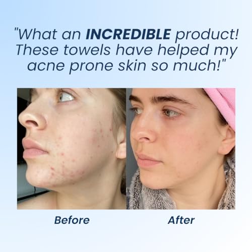 Clean Skin Club Clean Towels XL, Dermatologist Approved, 100% USDA CLEAN SKIN CLUB