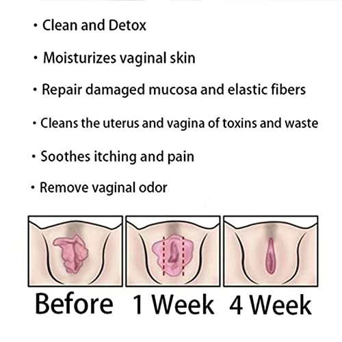 DASHENRAN Annie Care Natural Detox Viginal Capsules, Anniecare Instant Anti Itch Detox Slimming Products DASHENRAN