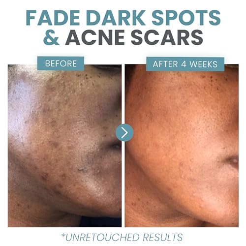 Eva Naturals Vitamin C Face Serum With Hyaluronic Acid - Anti Aging Serum Eva Naturals