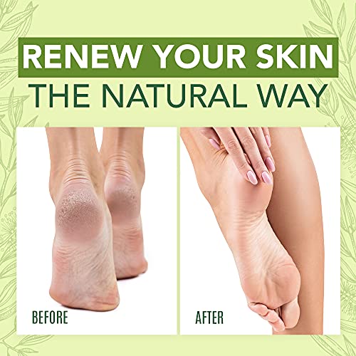Tea Tree Oil Foot Cream For Dry Cracked Heels Repair - Natural Foot Cream For Dry Cracke USA Naturals