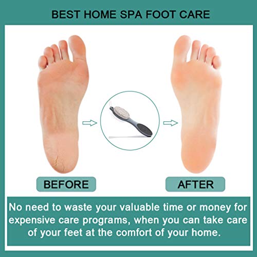 CAREHOOD Foot File Callus Remover - Multi Purpose 4 in 1 Feet Pedicure CAREHOOD