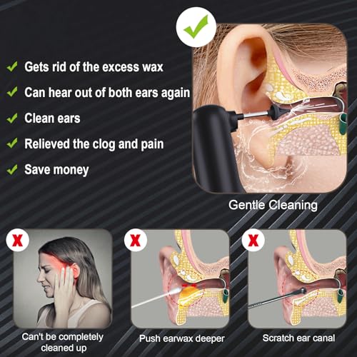 Upgraded Ear Wax Removal,Water Powered Ear Cleaner,Ear Cleaning Kit Alledge