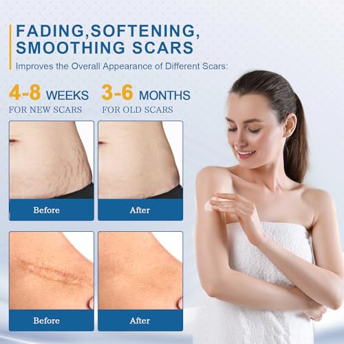 BORMSI Scar Cream,Active Silicone Dimethicone Scar Gel-Advanced BORMSI