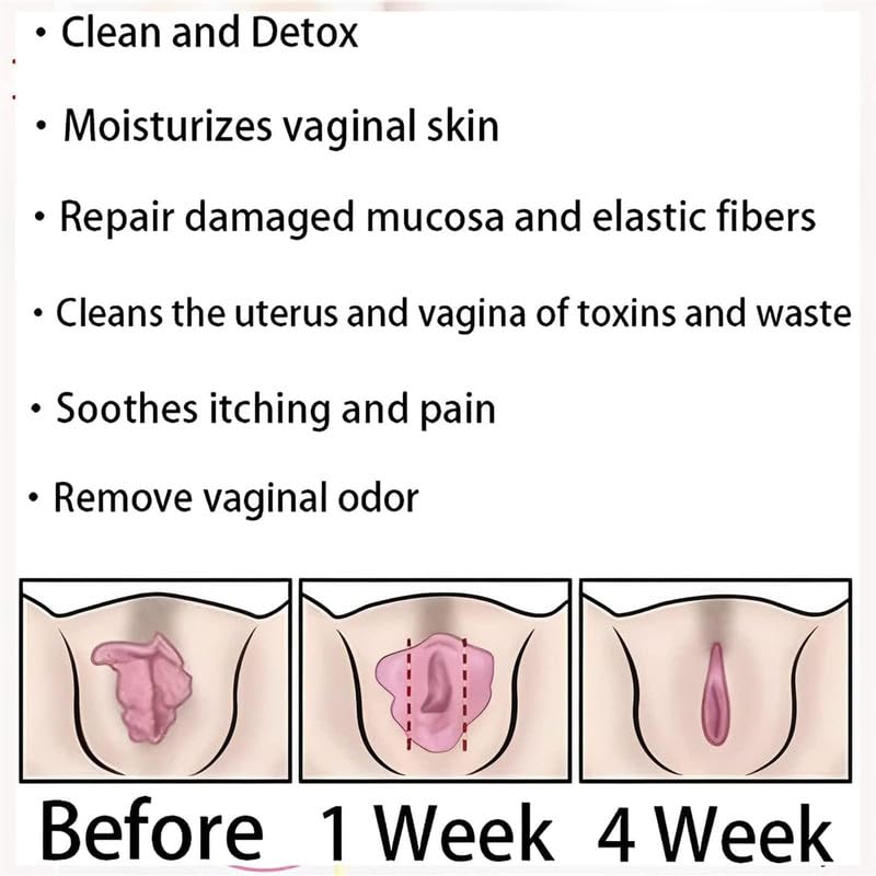 tsoneoo Dexcara Detox Repair - Natural Repair Vagianal Capsules, Natural Repair Vajinal Capsules tsoneoo