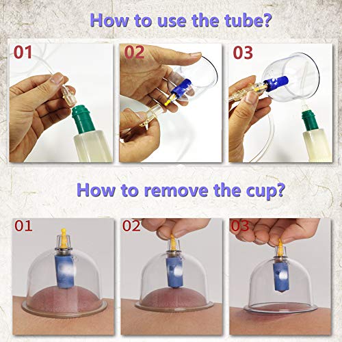MYMM 12 Cupping Cups Sets Biomagnetic Traditional Professional Chinese Therapy Massage MYMM
