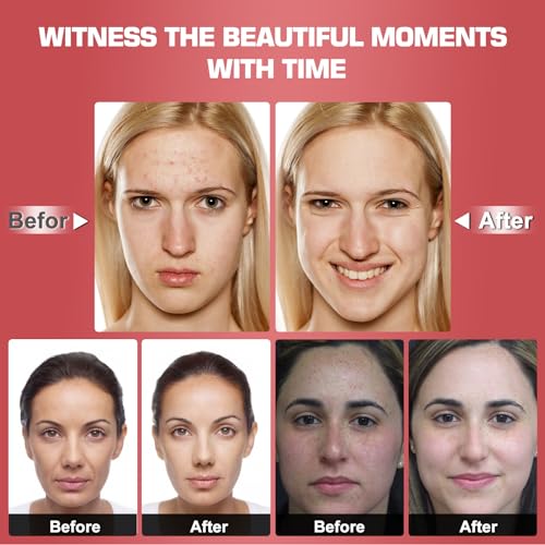 Red Light Therapy M-Ask Red Light Facial M-Ask Red Light Therapy for Face 7-1 Colors Light for Face Home Use LORICK