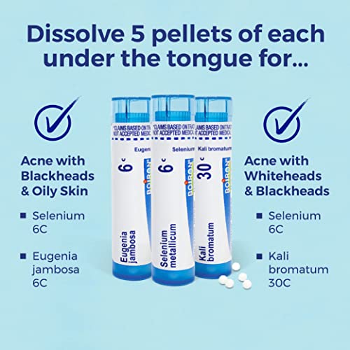 Boiron Acne Relief Kit for Blackheads, Oily Skins, Whiteheads on The Face and Body - 3 Count (240 Pellets) Boiron