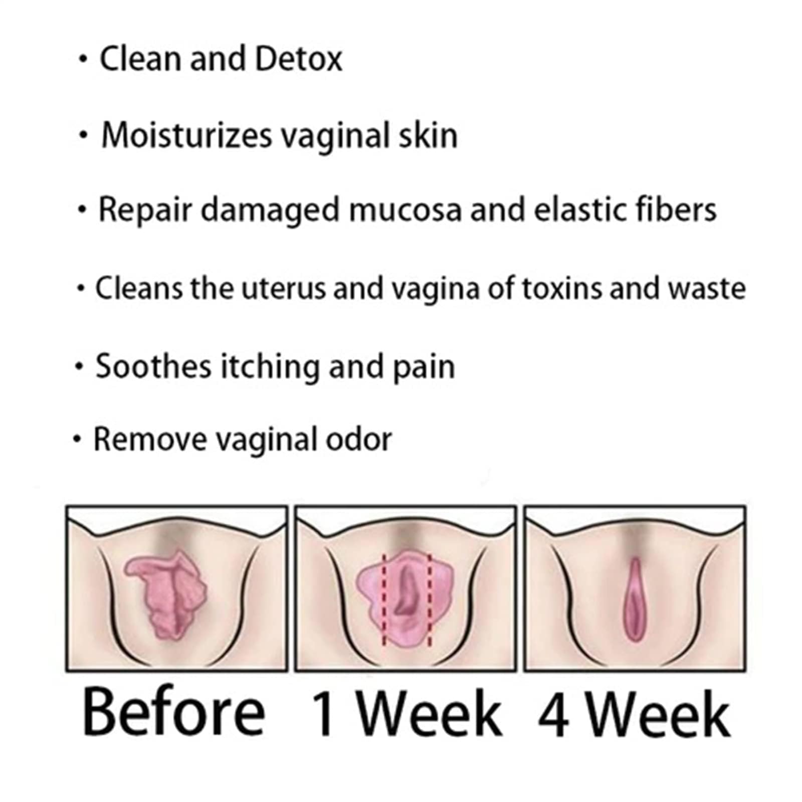 Dexcara - Dexcara Capsules, Dexcara Pills, Dexcara Natural, Dexcara Vaginal Tightening Konenbra