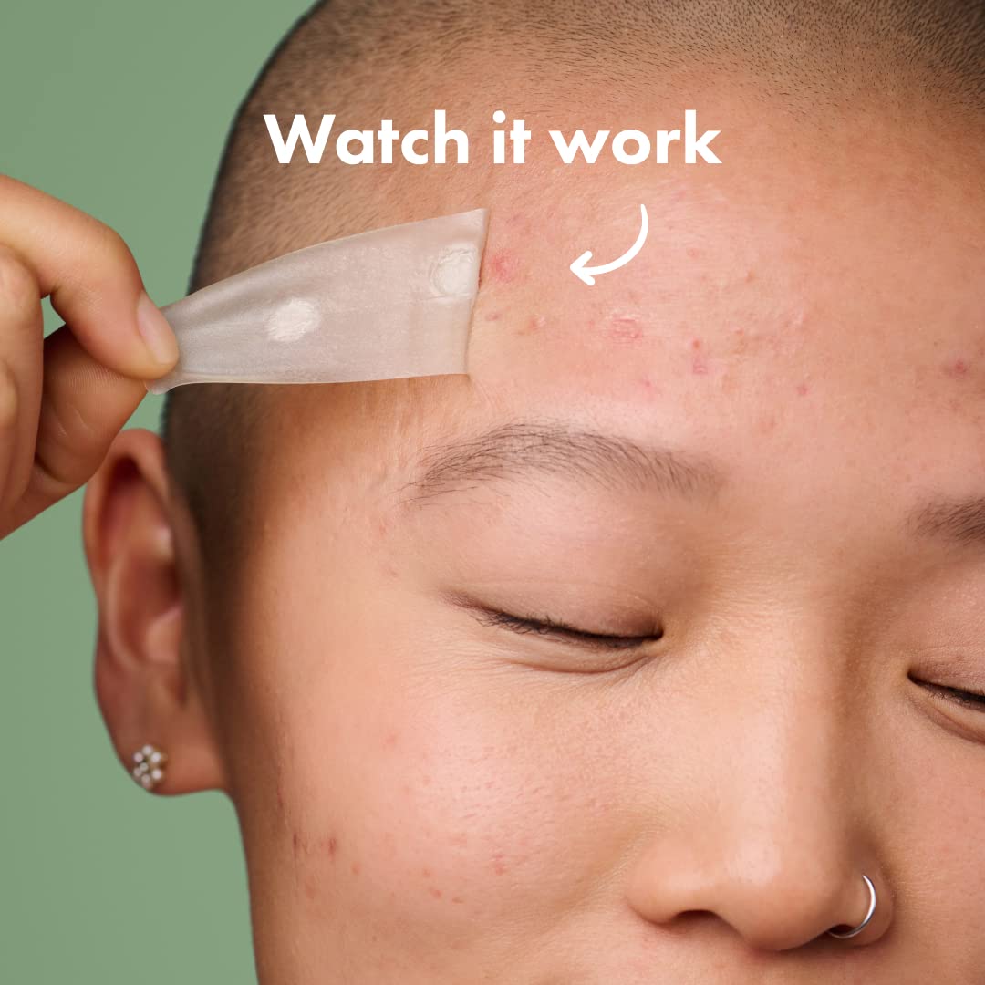 Mighty Patch™ Surface patch from Hero Cosmetics - Hydrocolloid Spot Patch for Body Mighty Patch