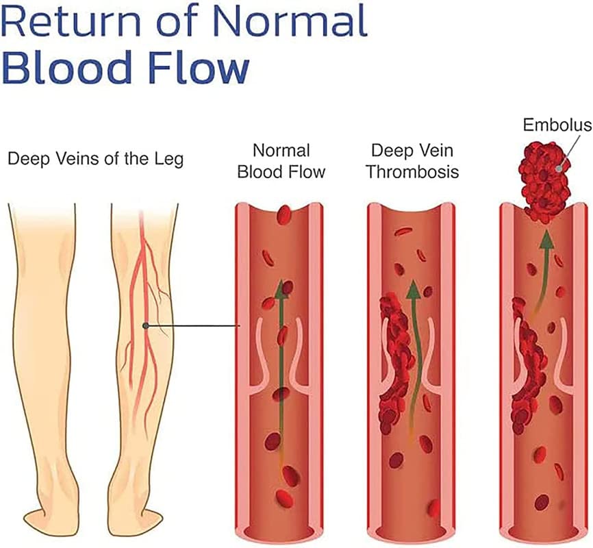 KNEECA Tourmaline Acupressure Selfheating Knee Sleeve, Tourmaline Acupressure Self