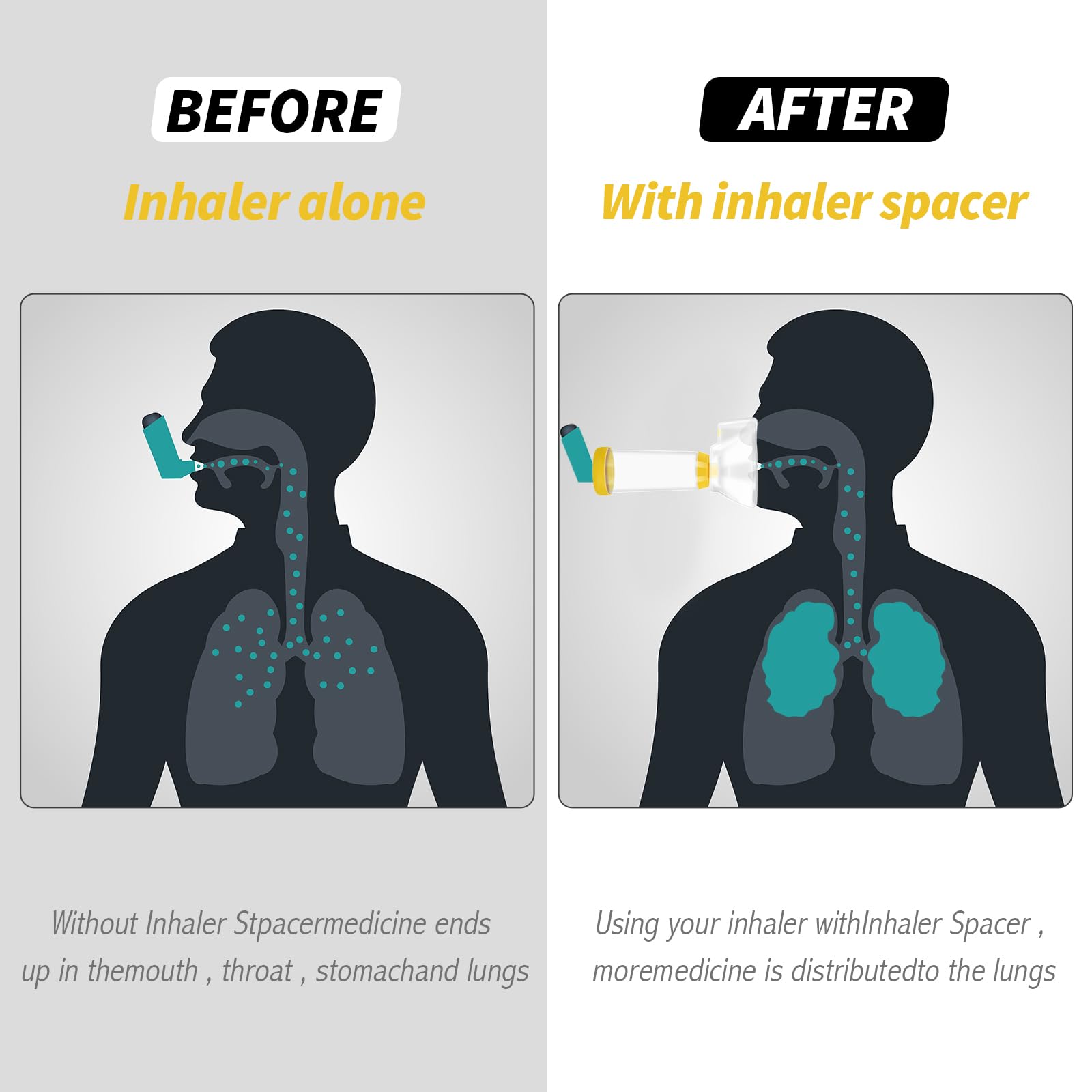 Fivepropy Handheld Spacer for Infant, Toddle, Baby, Kids and Adults with 2 Comfortable Fivepropy