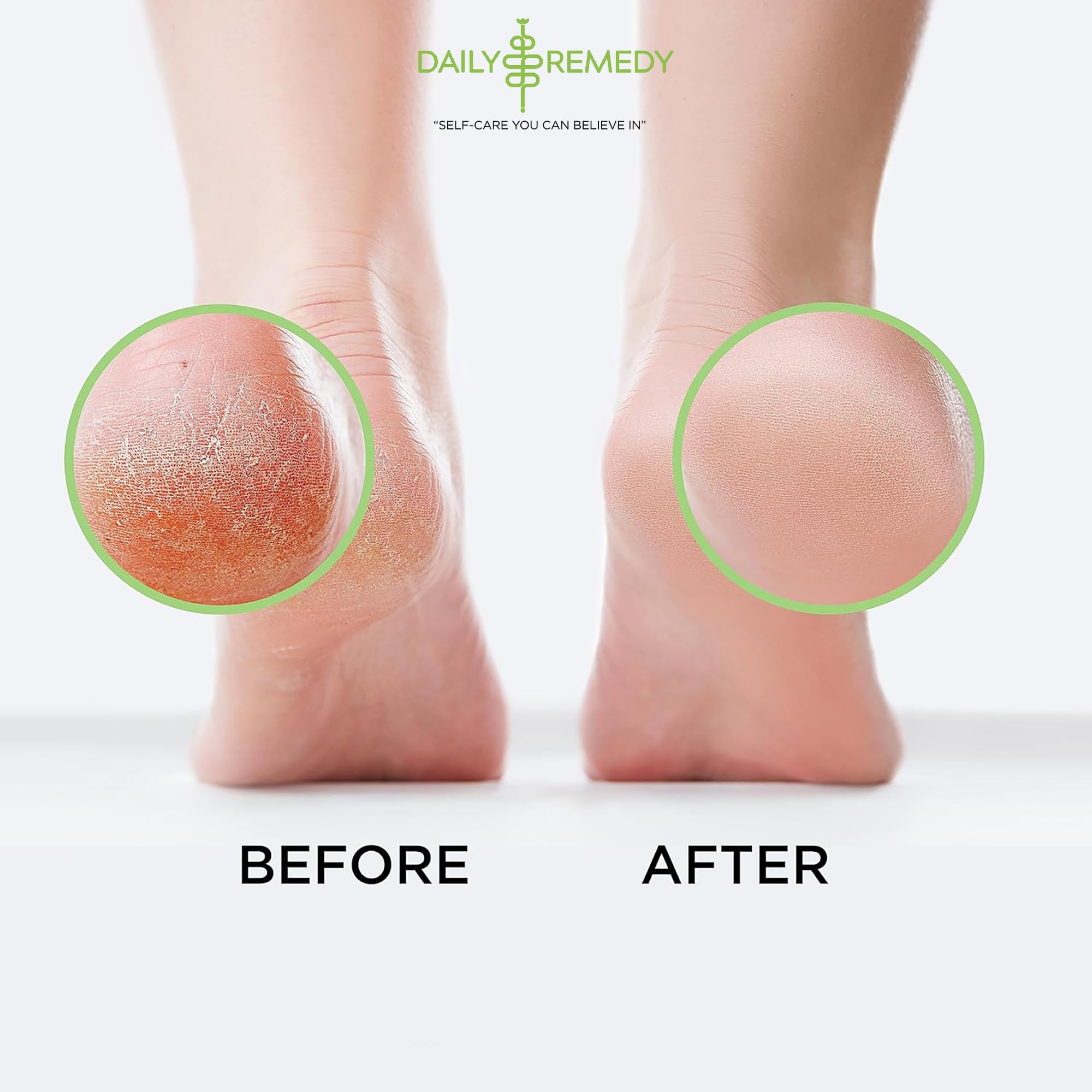 Tea Tree Oil Foot Soak with Epsom Salt - Made in USA - for Toenail Athletes Foot DAILY REMEDY