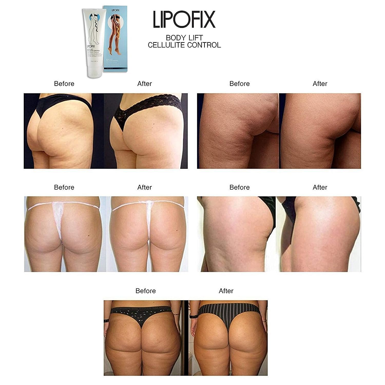 LIPOFIX Anti Cellulite Cream Luxurious Formula Body Contour Cream Effectively Tone LIPOFIX