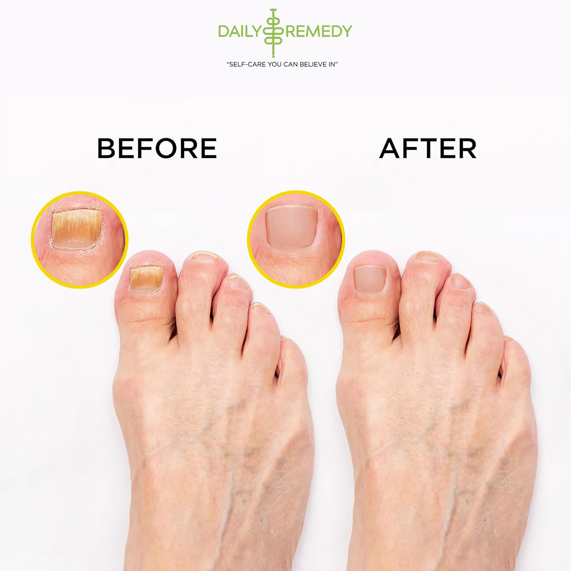 Citrus Detox Foot Soak with Epsom Salt - for Foot Callus, Immune Boost, Damaged Toenail DAILY REMEDY