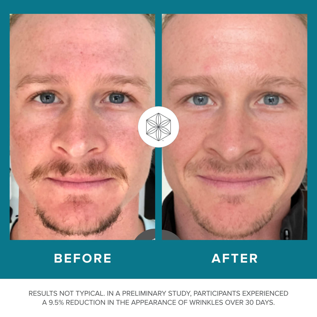 Isagenix Collagen Elixir - Collagen Drink with Marine Collagen Peptides - Liquid Collagen 