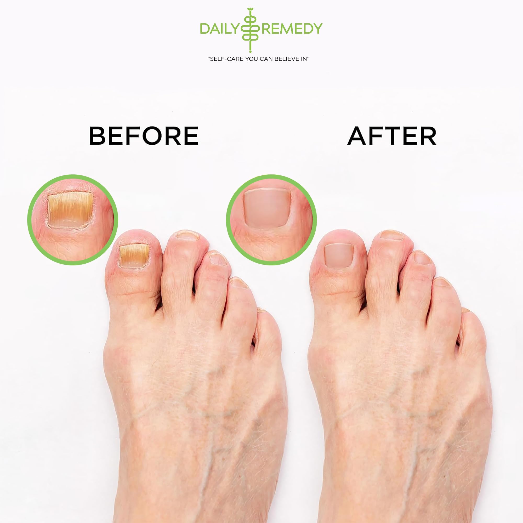 Tea Tree Oil Foot Soak with Epsom Salt - Made in USA - for Toenail Athletes Foot DAILY REMEDY