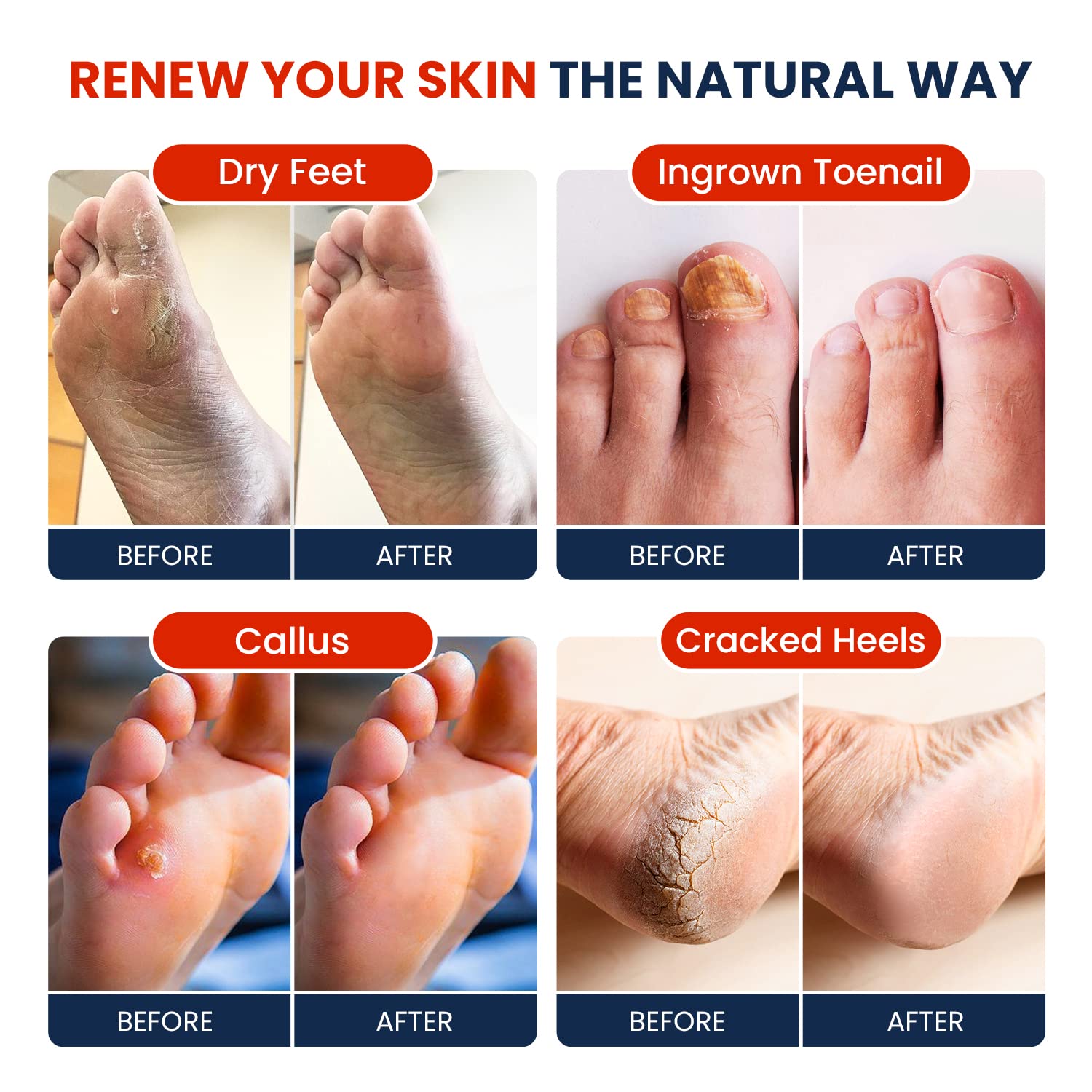 Muscle Relief Foot Soak with Epsom Salts - All Natural Salts for Post Workout Recovery FOOT CURE