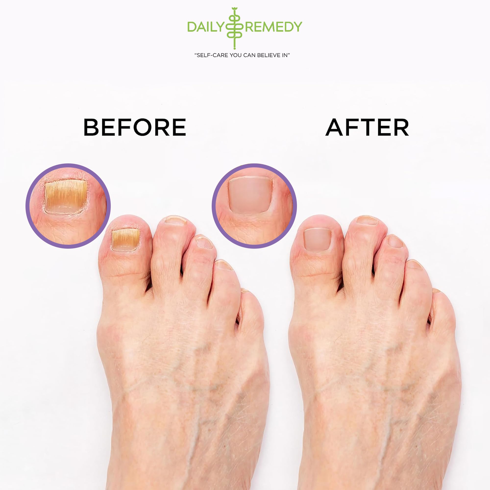 Calming Lavender Foot Soak with Epsom Salt, Made in USA, Foot Soak Soothes Sore Tired DAILY REMEDY