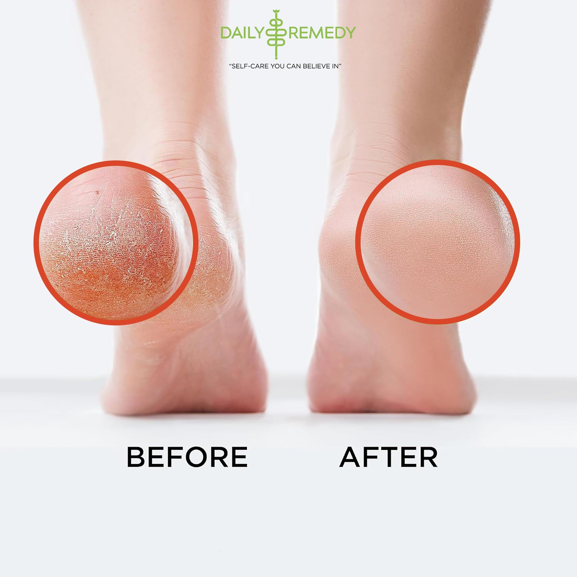 Muscle Relief Foot Soak with Epsom Salt, Made in USA, Soothe Foot Aches, Muscle Pain DAILY REMEDY