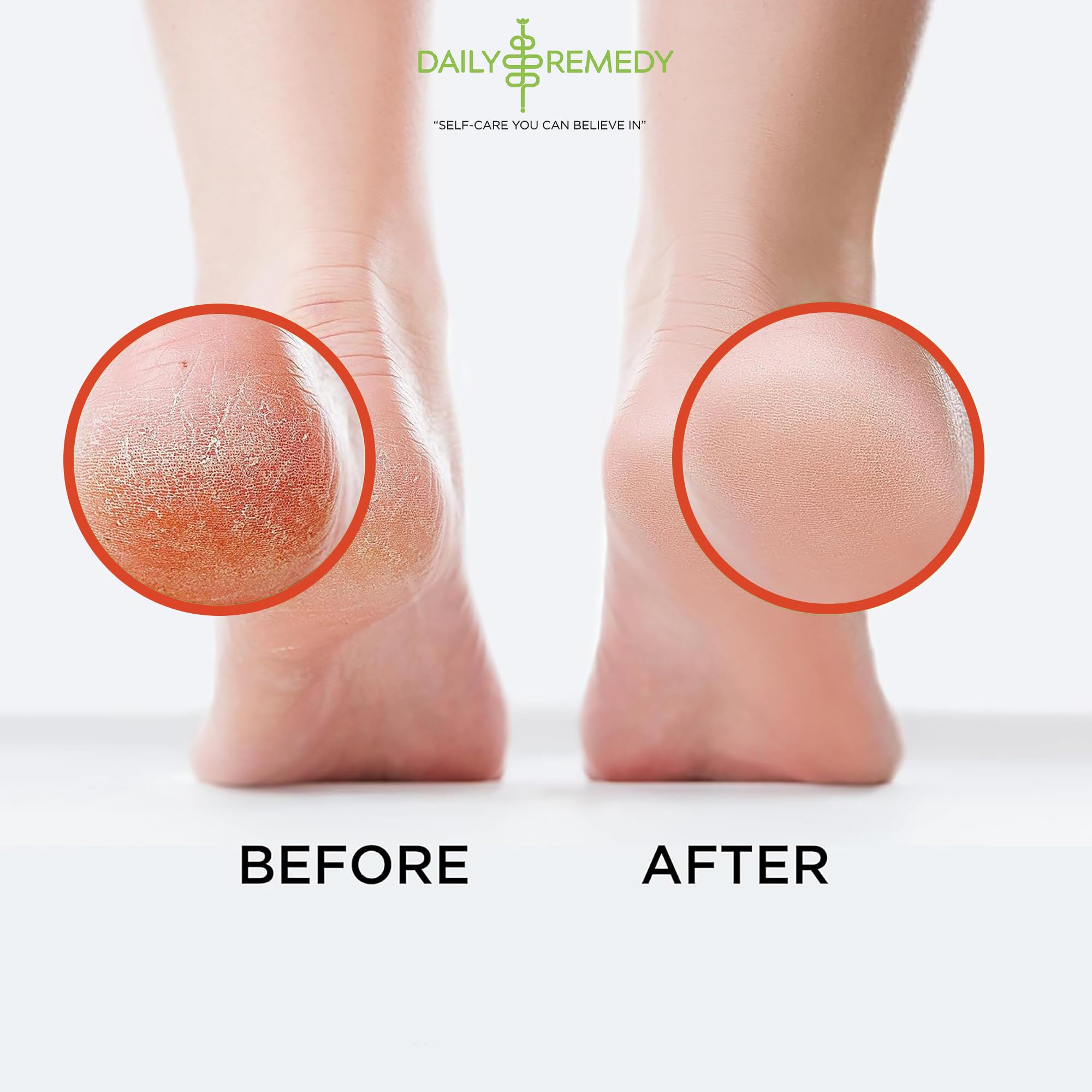 Muscle Relief Foot Soak with Epsom Salt, Made in USA, Soothe Foot Aches, Muscle Pain DAILY REMEDY