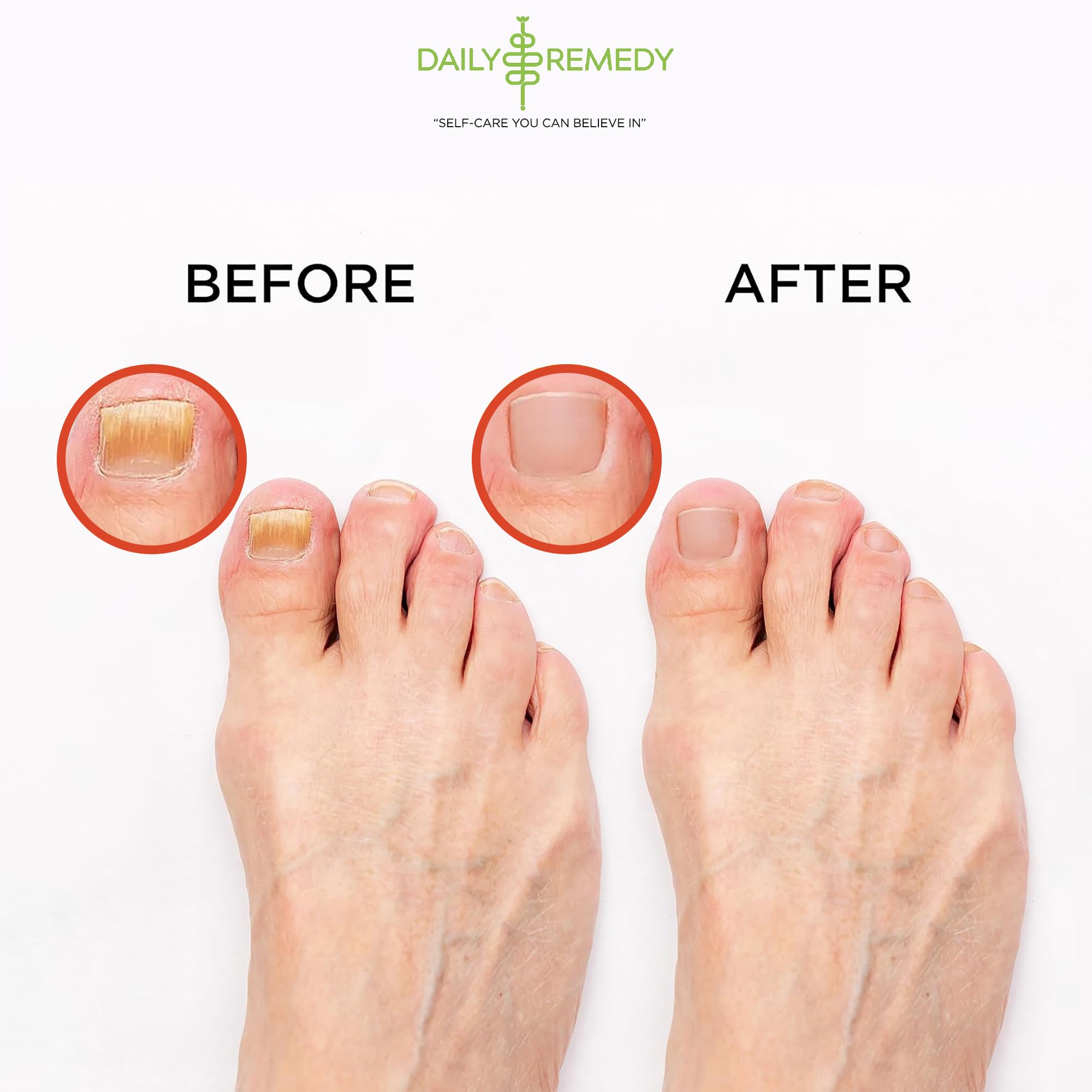 Muscle Relief Foot Soak with Epsom Salt, Made in USA, Soothe Foot Aches, Muscle Pain DAILY REMEDY