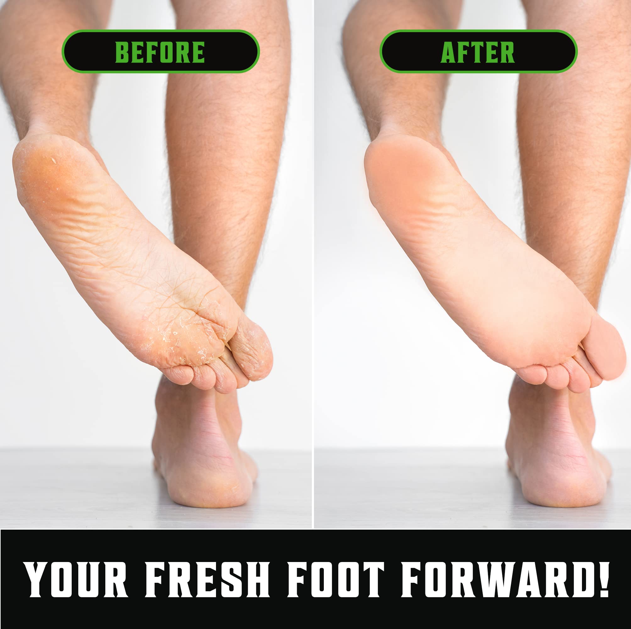 Viking Revolution Skin Cleaning Agent Tea Tree Kit for Men - Tea Tree Oil Set with Body Viking Revolution