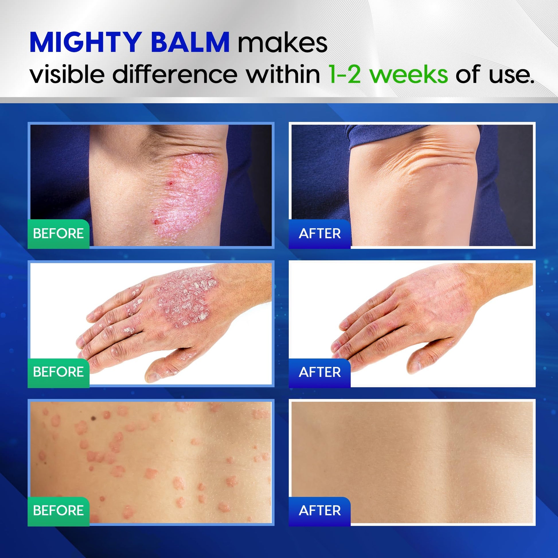 Tobcharm Antifungal Cream, Antifungal Cream for Skin, Ringworm Treatment for Humans Tobcharm