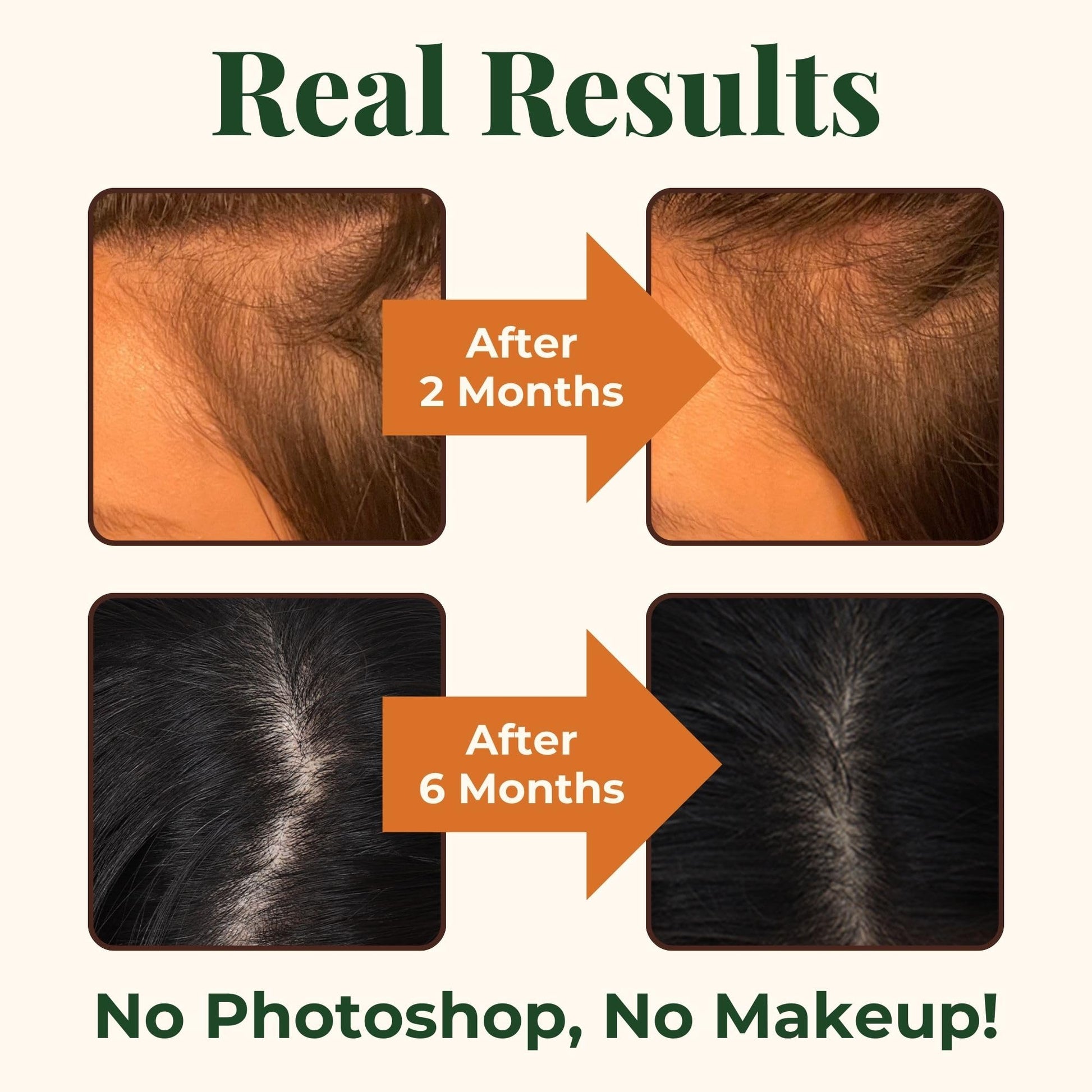 Heebin's Royal Hair, Brows & Lashes, Hair Growth Vitamins with Biotin 4000 mcg, Collagen Heebin's