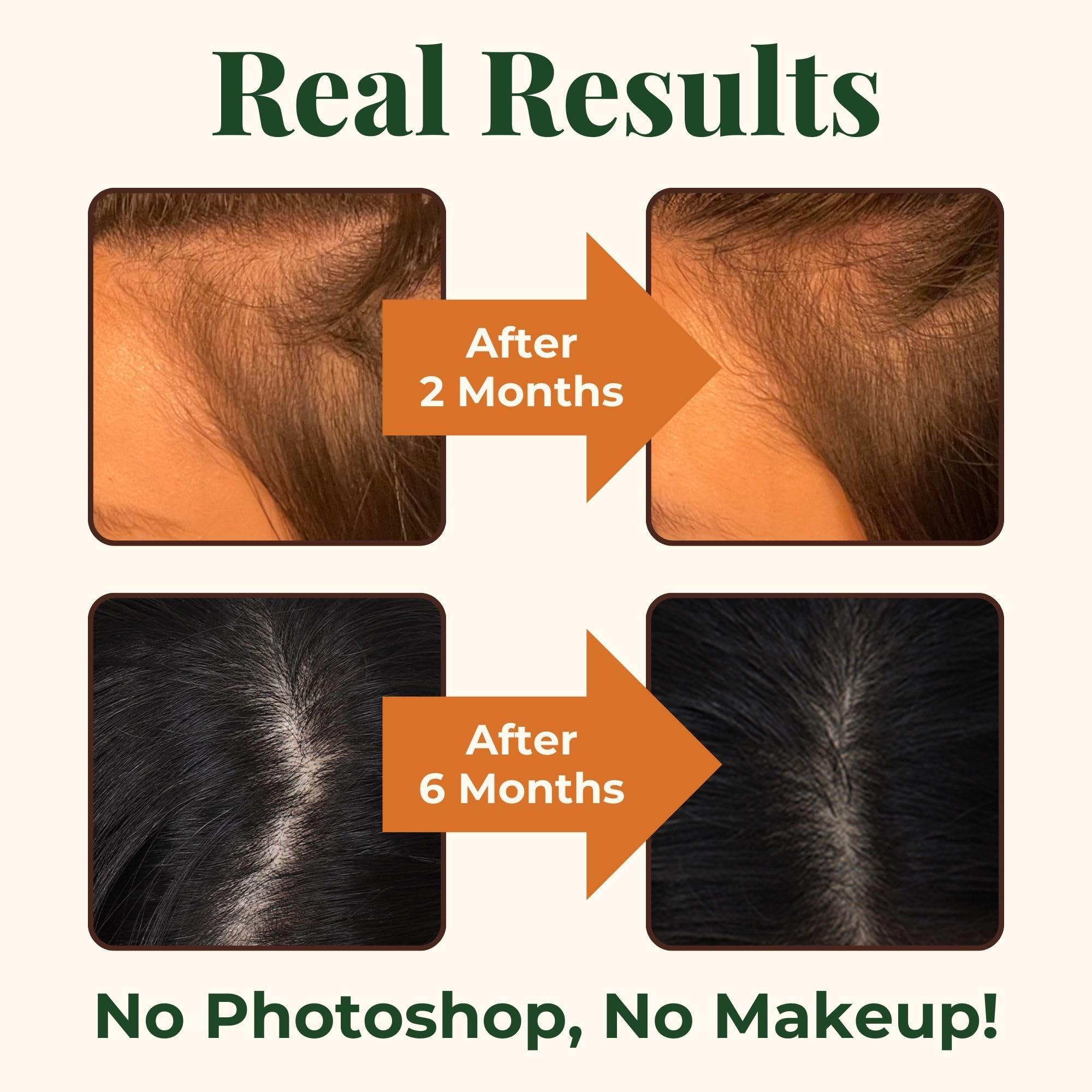 Heebin's Royal Hair, Brows & Lashes, Hair Growth Vitamins with Biotin 4000 mcg, Collagen Heebin's