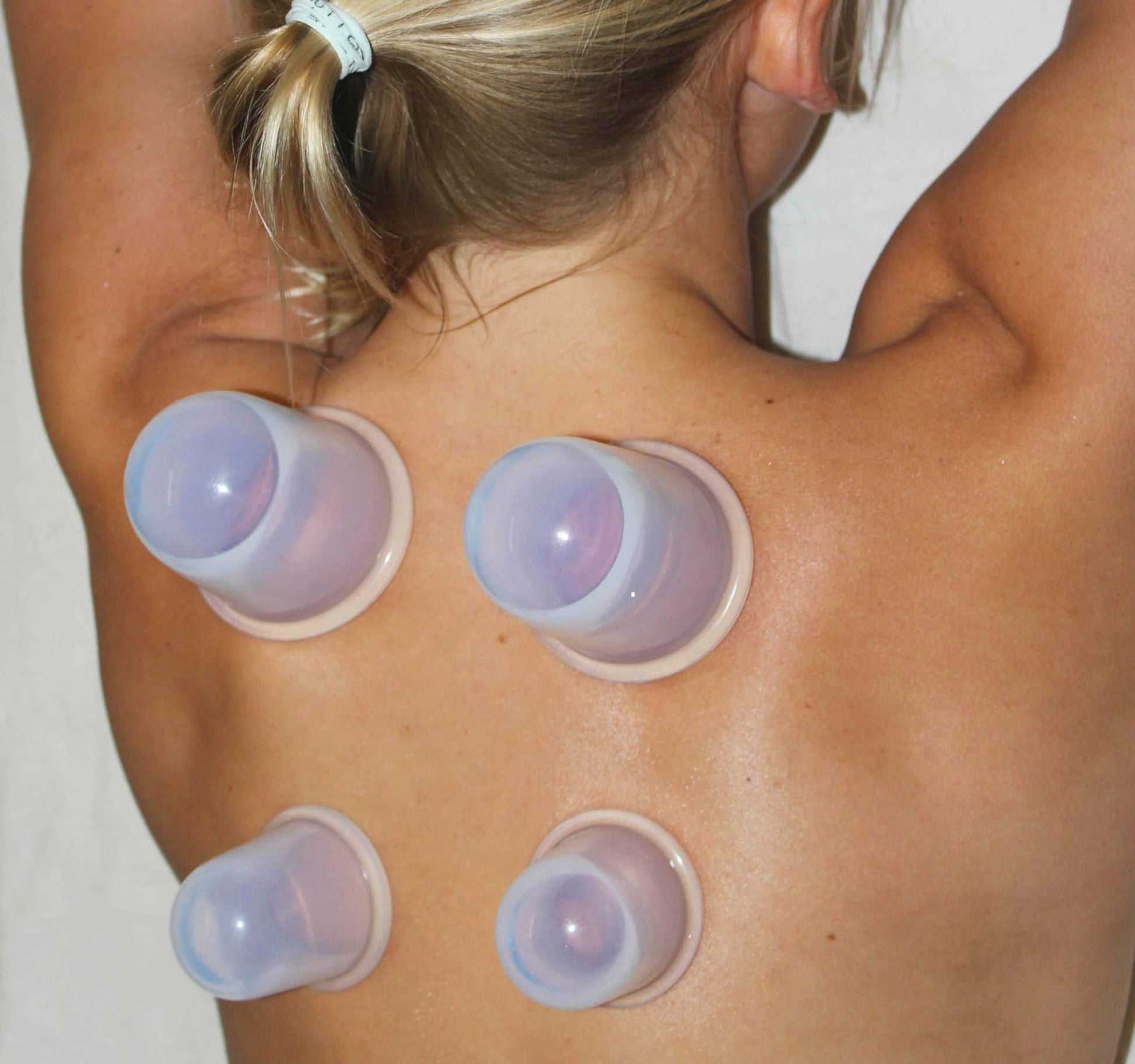 Cupping Kit for Massage Therapy - by DoSensePro, Cupping Set of 6 Professional Silicone Cups DoSensePro