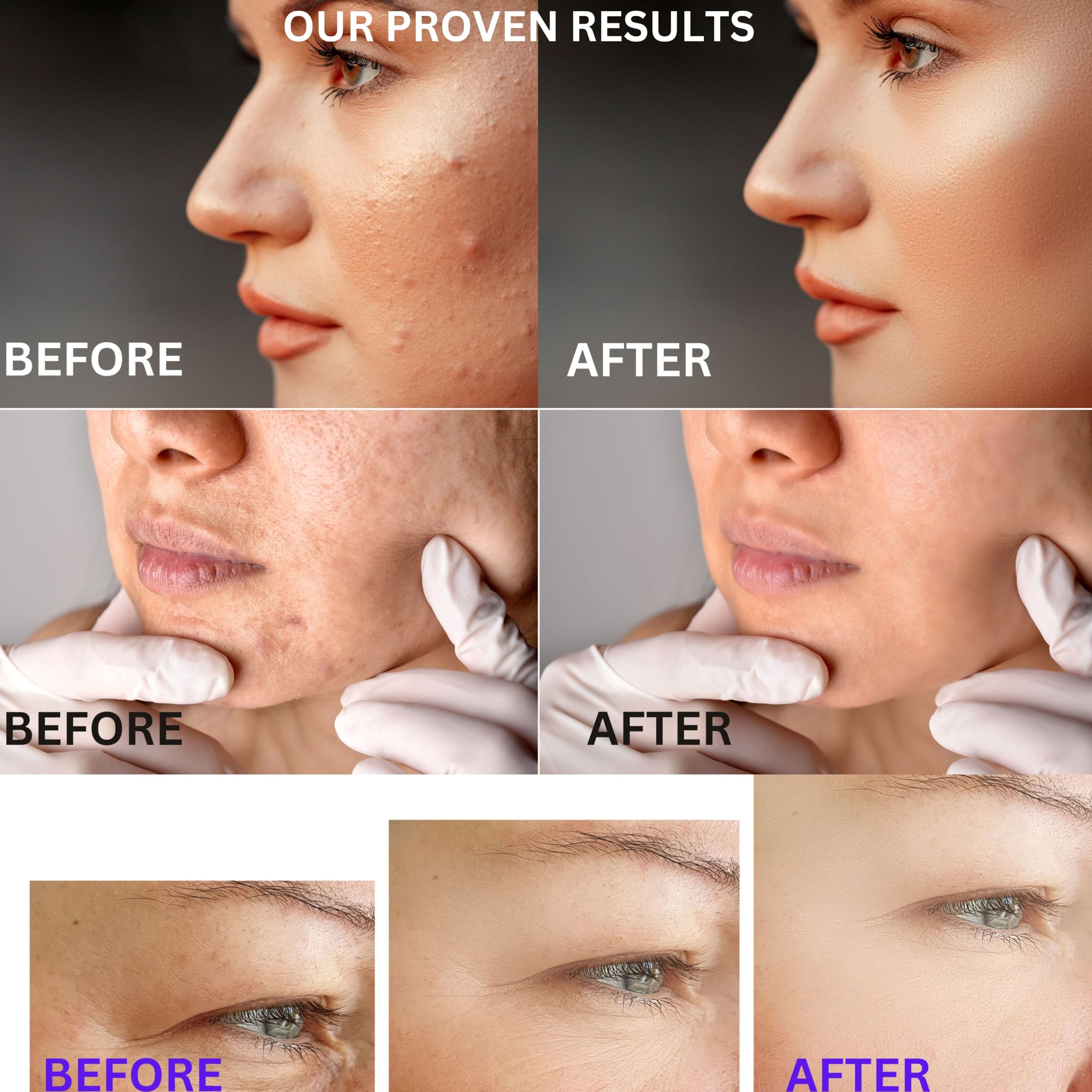 SkinVitalize C E ferulux Vitamin C Serum - 30ml: Advanced Formula for Fighting with Wrinkles Msupps.com