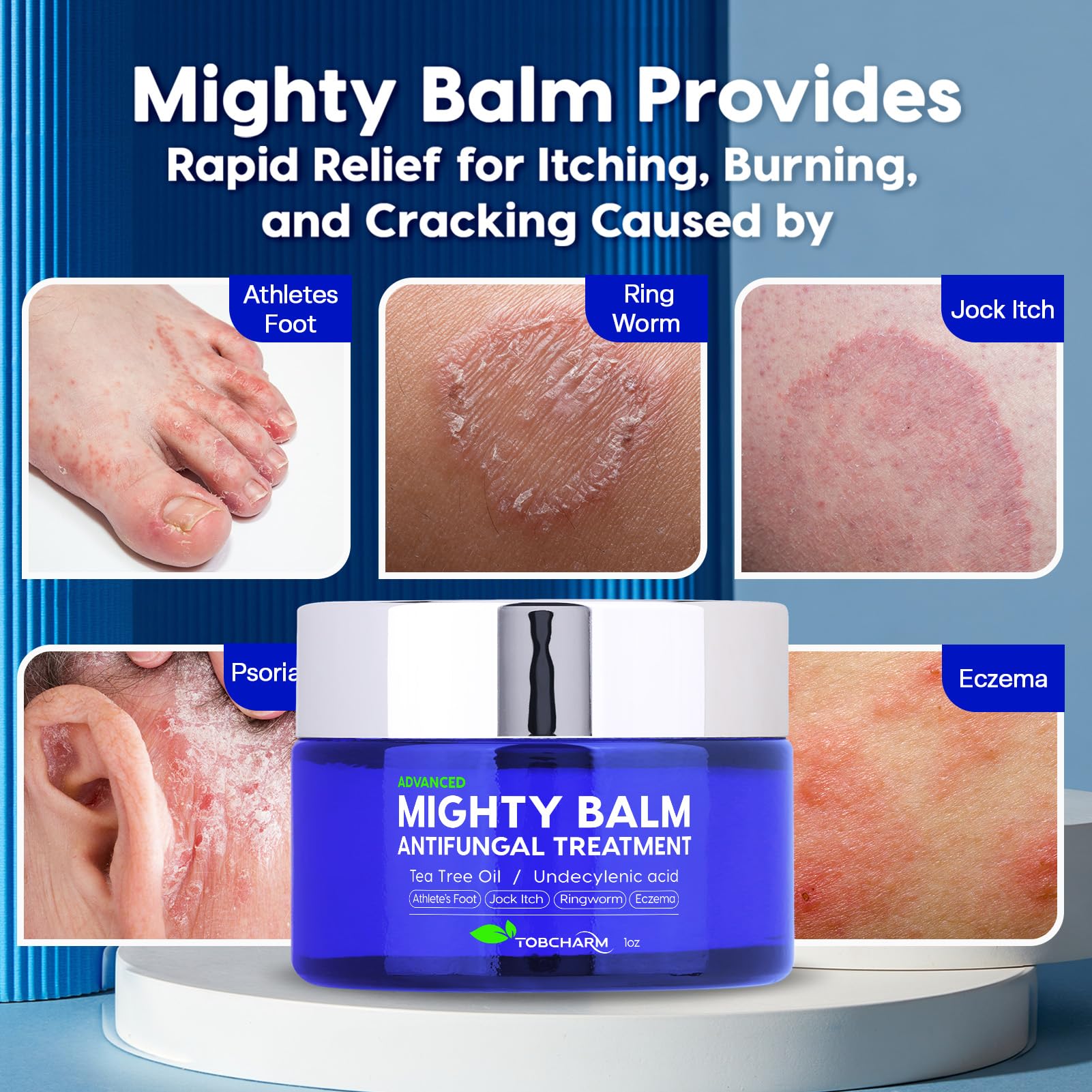 Tobcharm Antifungal Cream, Antifungal Cream for Skin, Ringworm Treatment for Humans Tobcharm